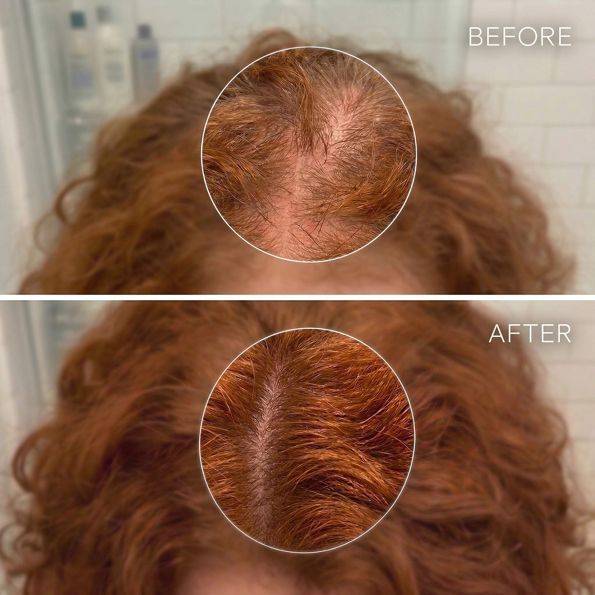 Heeyul® Anti Hair Loss Ampoule
