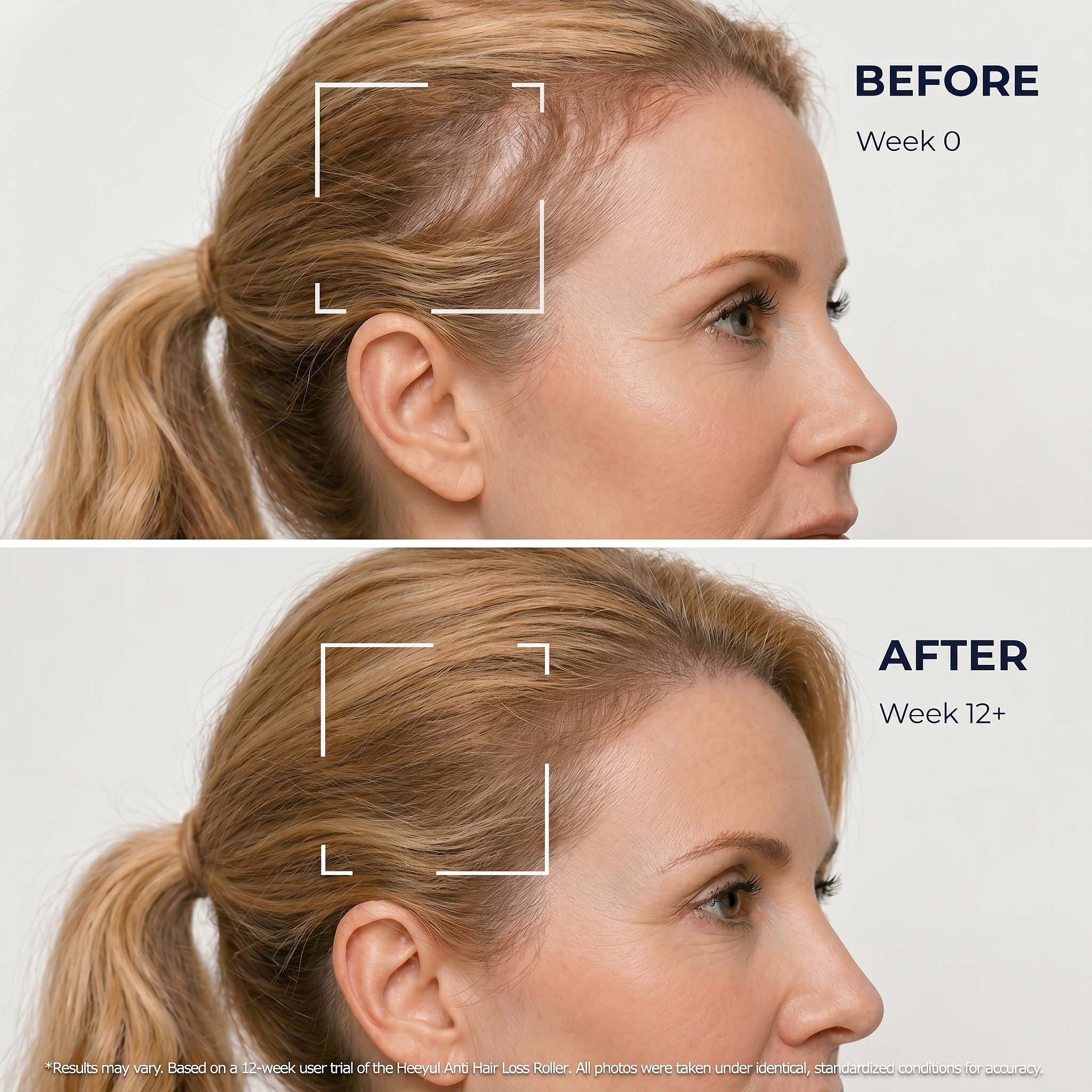 Heeyul® Anti Hair Loss Ampoule