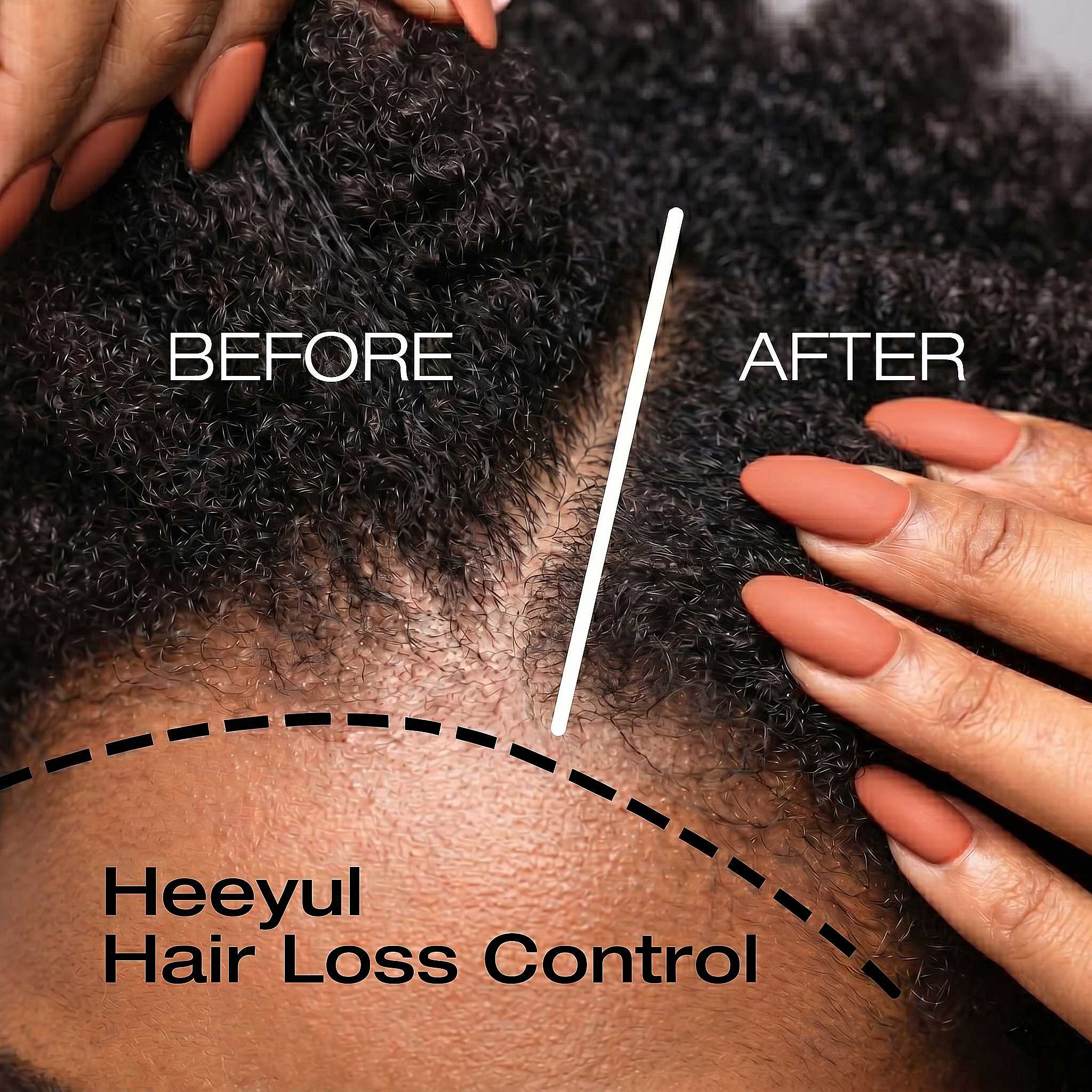 Heeyul® Anti Hair Loss Ampoule